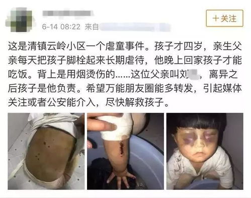 结扎可以挽回吗表字,结扎后是否还有挽救的机会