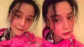 整容失败如何去挽回婚姻，挽回失败整容婚姻，怎么办？