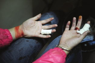 自残挽回女友会咋个,挽回女友竟自残，如何应对？