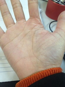 经历绝望挽回生命,绝望中寻找生命线