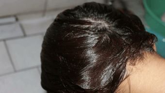 挽回脱发的正确方法,有效挽救脱发的正确做法