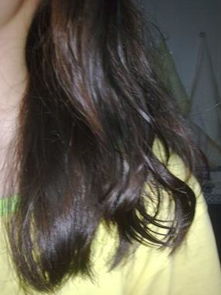 怎么挽回头发,如何恢复秀发？