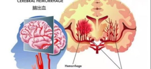 大脑生锈怎么挽回方法,挽回大脑生锈，方法不难找