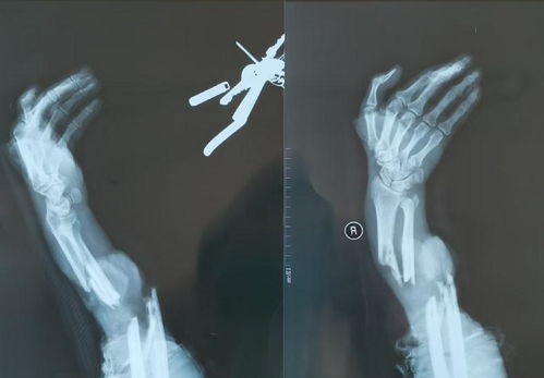 剑折断了怎么挽回,剑断了怎么复合？