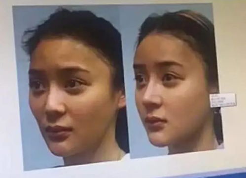 整容后挽回前夫电影，整形美容走上复婚路