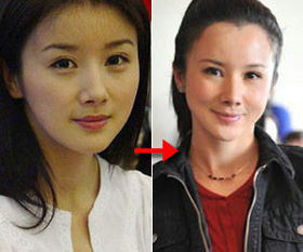 女人整容成功挽回丈夫,女子整容成功，成功挽回丈夫（29字）