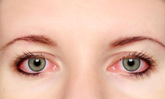 挽回眼睛最快的方法,快速缓解眼疲劳的方法