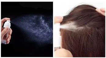 挽回脱发最好的方法,如何最有效地挽救脱发？