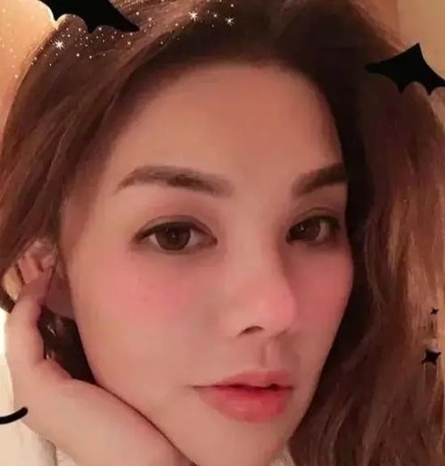 整容108次后挽回，女子经历108次整容后成功重获美貌