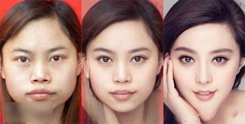 整容后挽回前夫图片,整容后成功挽回前夫，惨遭抨击的她如今注定改写人生