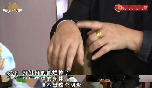 前夫假装重病挽回前妻,前夫伪病挽回前妻