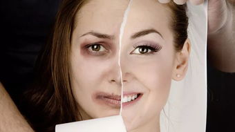 整容挽回丈夫的心态,整容不如自信：挽回丈夫的心态