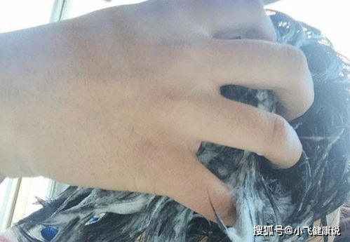 纹身毁了还会挽回吗,能否挽回一次纹身毁约的错误？