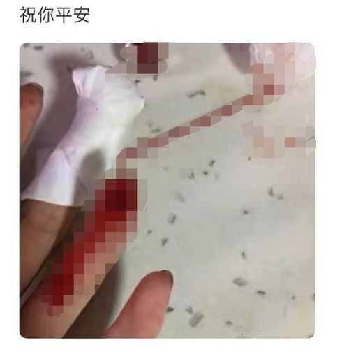 自残可以挽回对方吗,自残拯救爱情？如此做法不值得推荐)