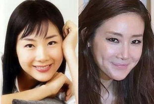 韩剧整容成功挽回前夫,整容后成功挽回前夫