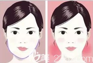 长得丑如何挽回,如何改善自己的外貌？