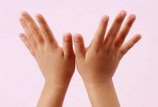 扎手指血挽回术，手指出血如何止血？小妙招分享