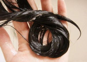 发际线能挽回吗,如何挽救发际线？