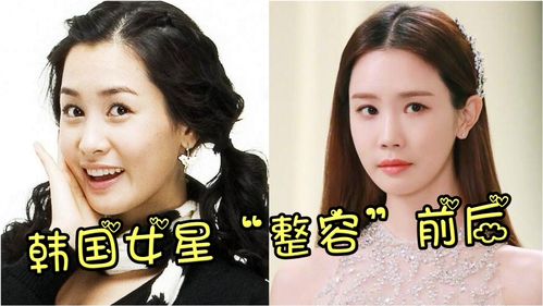 整容成功挽回前夫的视频，女子整容后神似女神，成功复婚！