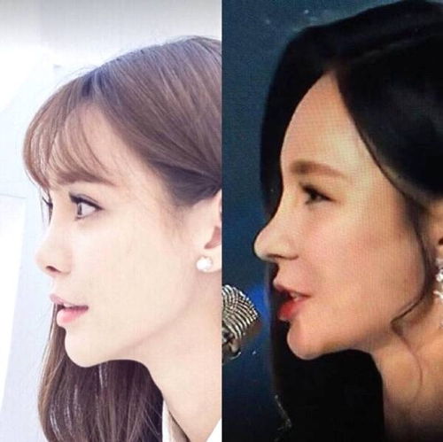 整容后挽回男朋友,从整容到挽回，女孩成功挽回男友！