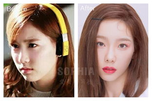 堂妹整容能挽回吗,堂妹整容可否挽回美貌