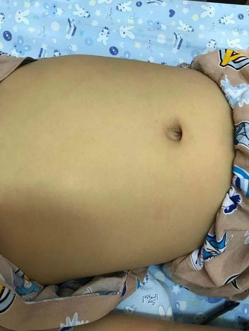 被结核毁掉如何挽回，如何拯救身染结核的生命？