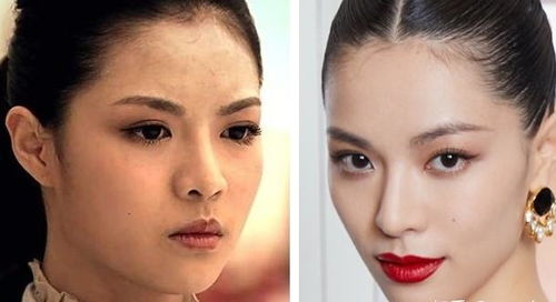 原配整容成功挽回前夫,成功整容挽回前夫