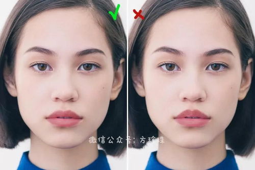 整容利息太高怎么挽回，如何降低整容手术所需的高额利息？