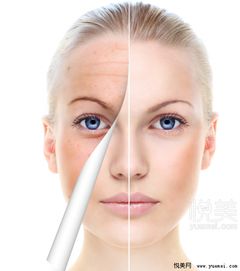 瘦脸针怎么挽回,如何有效恢复瘦脸针效果