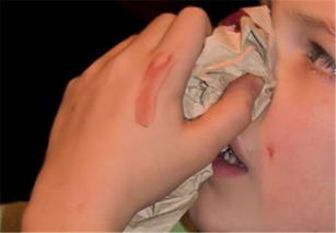 自残可以挽回她吗，自我伤害是否可以挽回她？