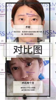 如何挽回自己的脸型,如何改善脸型，重拾自信