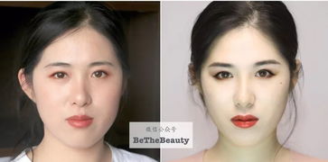 整容竟为挽回变心丈夫，整形手术为赢回丈夫心意，妻子何去何从？