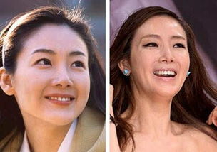 女人整容成功挽回丈夫,女子整容成功，成功挽回丈夫（29字）