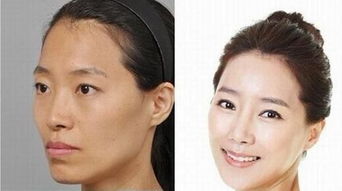 美女整容成功挽回男人,美女整容成功复合