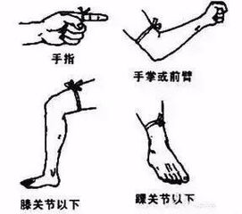 被蛇咬了怎么挽回,被蛇咬后的自救方法