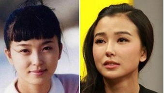 妻子整容后挽回丈夫,妻子成功整容后重拾丈夫的心