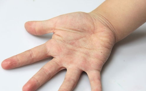 指甲受损能挽回吗,如何挽回受损指甲？