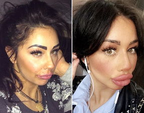 女人整容成功挽回前夫,整容后挽回前夫成功，女人夺回爱情