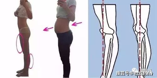 胯宽怎么挽回,怎样挽回胯宽？