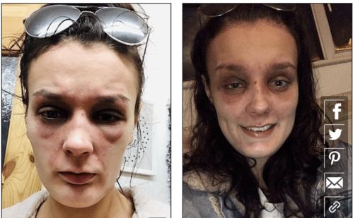 挽回妻子用刀令其毁容,丈夫为挽回妻子用刀毁容