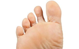 脚烂了怎么挽回伤口,如何有效修复脚受伤的情况