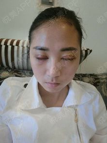 整容挽回老公杨桂，整形后重获男友心，她的秘诀是什么？