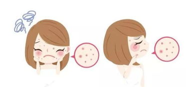 熬夜完后怎么挽回，赶紧救救熬夜后的肌肤！