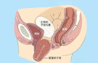 胎儿胆囊积液怎么挽回,胎儿胆囊积液如何治疗？