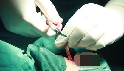 结扎可以挽回吗女人,女人绝育后还能挽回吗？