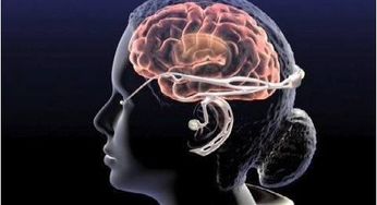 大脑长期缺氧怎么挽回,如何改善大脑长期缺氧状态？