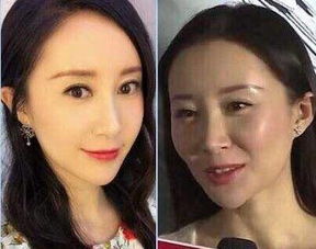 整容后挽回前夫图片,整容后成功挽回前夫，惨遭抨击的她如今注定改写人生