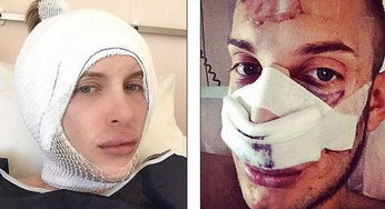 整容竟为挽回变心丈夫，整形手术为赢回丈夫心意，妻子何去何从？