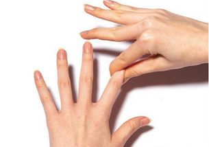 意外失去指节怎么挽回,失去手指关节后如何康复