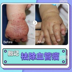 挽回身上的痕迹,消除身上的痕迹，重获新生